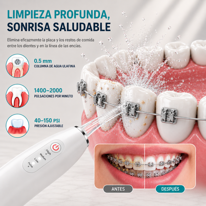 Irrigador Bucal para Brackets — Limpieza Profunda en Casa